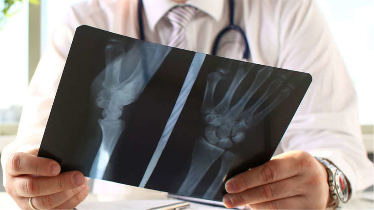 IMPORTANCE OF ORTHOPAEDIC CARE