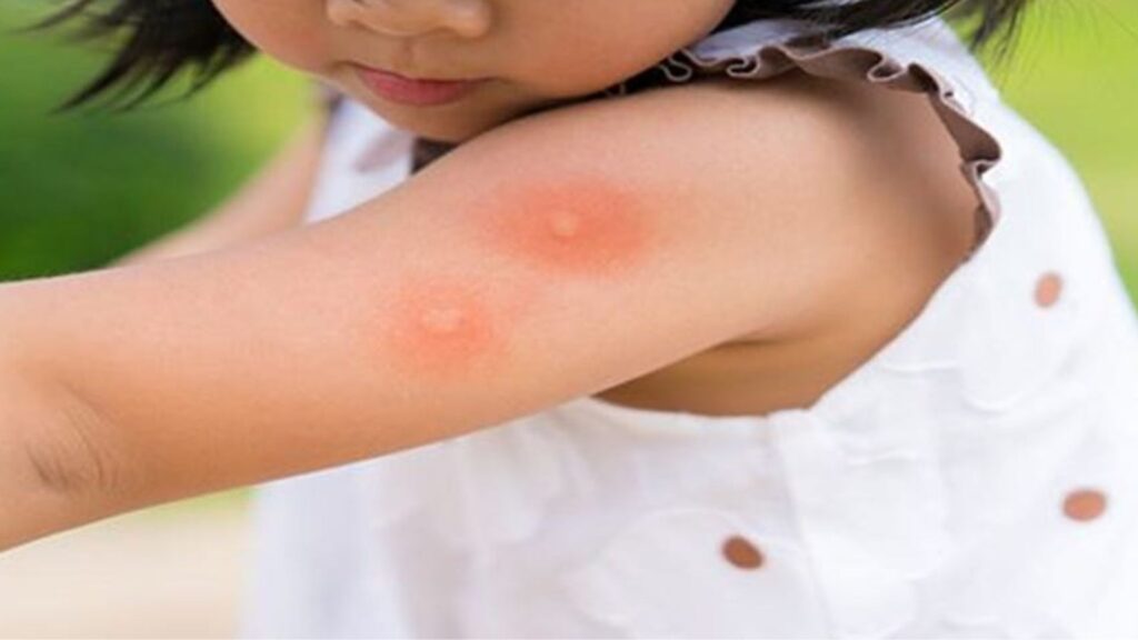 mosquito borne diseases mosquito borne diseases