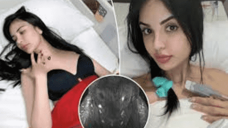 Brazilian Influencer  Million Butt Lift Fillers To Look Like Kim Kardashian Makes Her Infertile