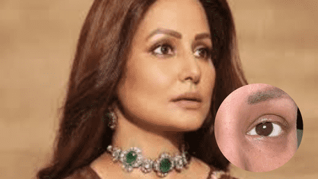 Hina Khan’s ‘Last Eyelash’ Inspires Her Final Chemo Cycle: Pic