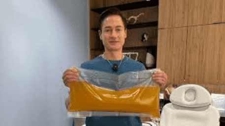 Super Plasma: ‘Gold In Blood’, Bryan Johnson’s Secret To Reversing Aging?