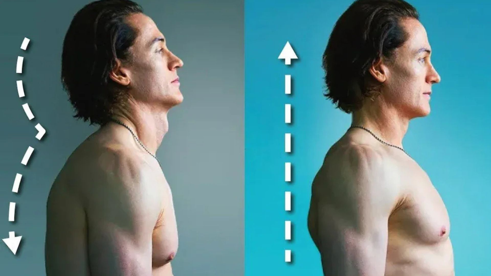 Tech Millionaire Bryan Johnson Reveals Posture Fix That Transformed His Brain Health After Alarming MRI Scan