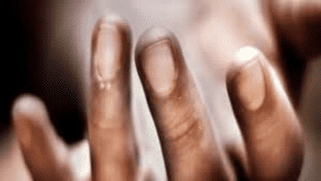 Delhi: Woman Cuts Husband’s Private Parts After An Argument