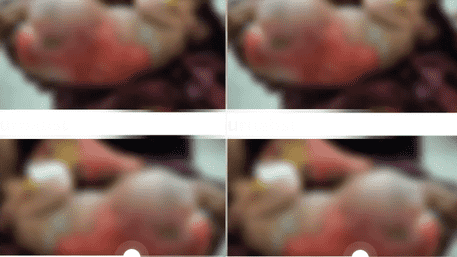 ‘Drug-Addict’ Mother Throws Newborn Into Stove, Baby Suffers 50% Burns | FULL VIDEO