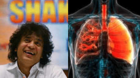 Idiopathic Pulmonary Fibrosis Disease: Zakir Hussain’s Deadly Disease Behind His Passing