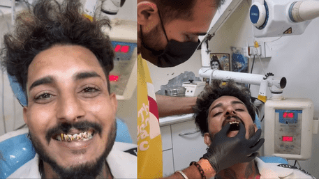 Man Gets His Natural Teeth Removed For Gold Teeth With His Name Inscribed | WATCH