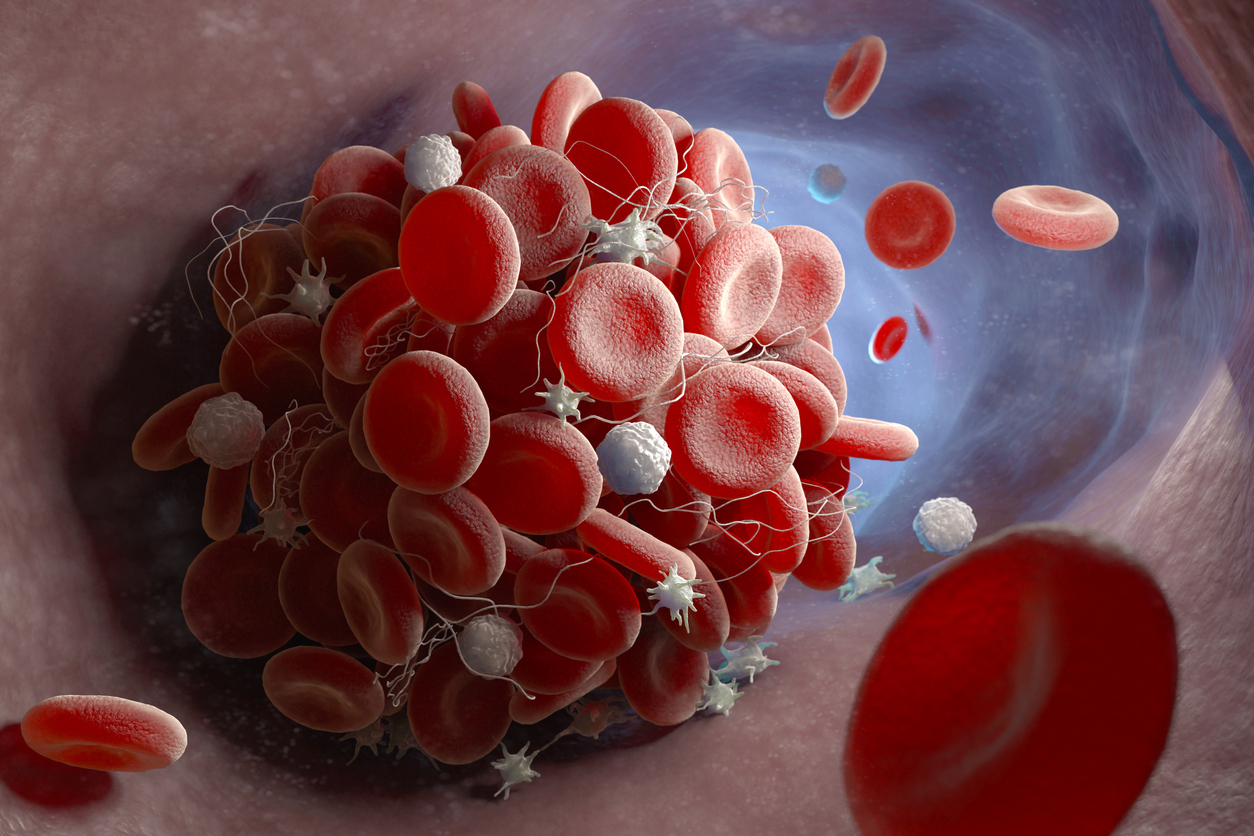 Air Pollution Linked to Increased Risk of Blood Clots: What You Need to Know
