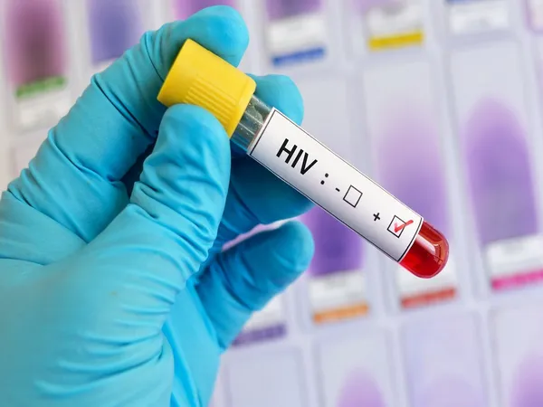 Social Programs Could Slash HIV Spread by 29%, Study Reveals
