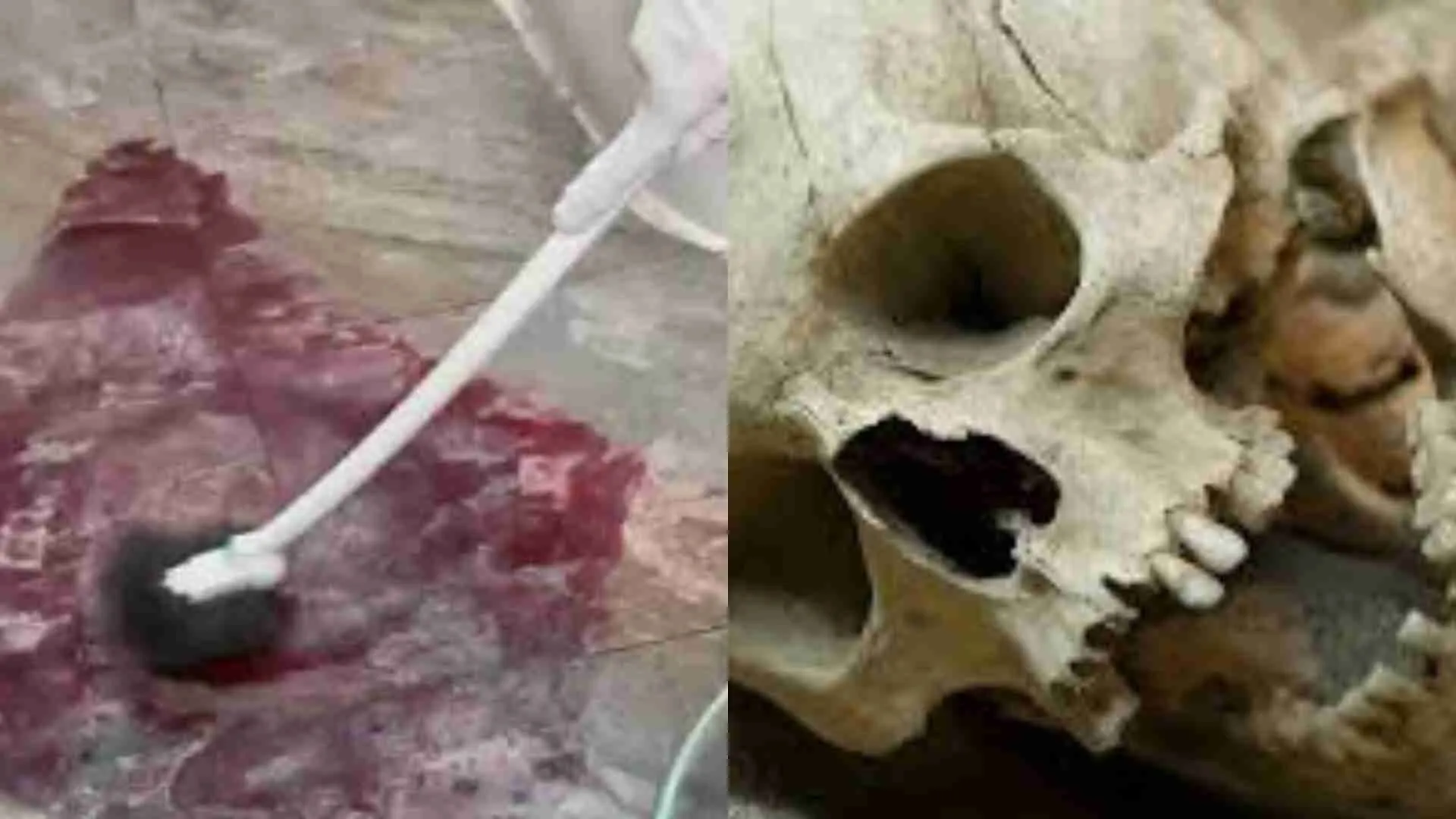 How To Dissolve Bones And Clean Bloodstains: Chinese Influencer Shows How To It