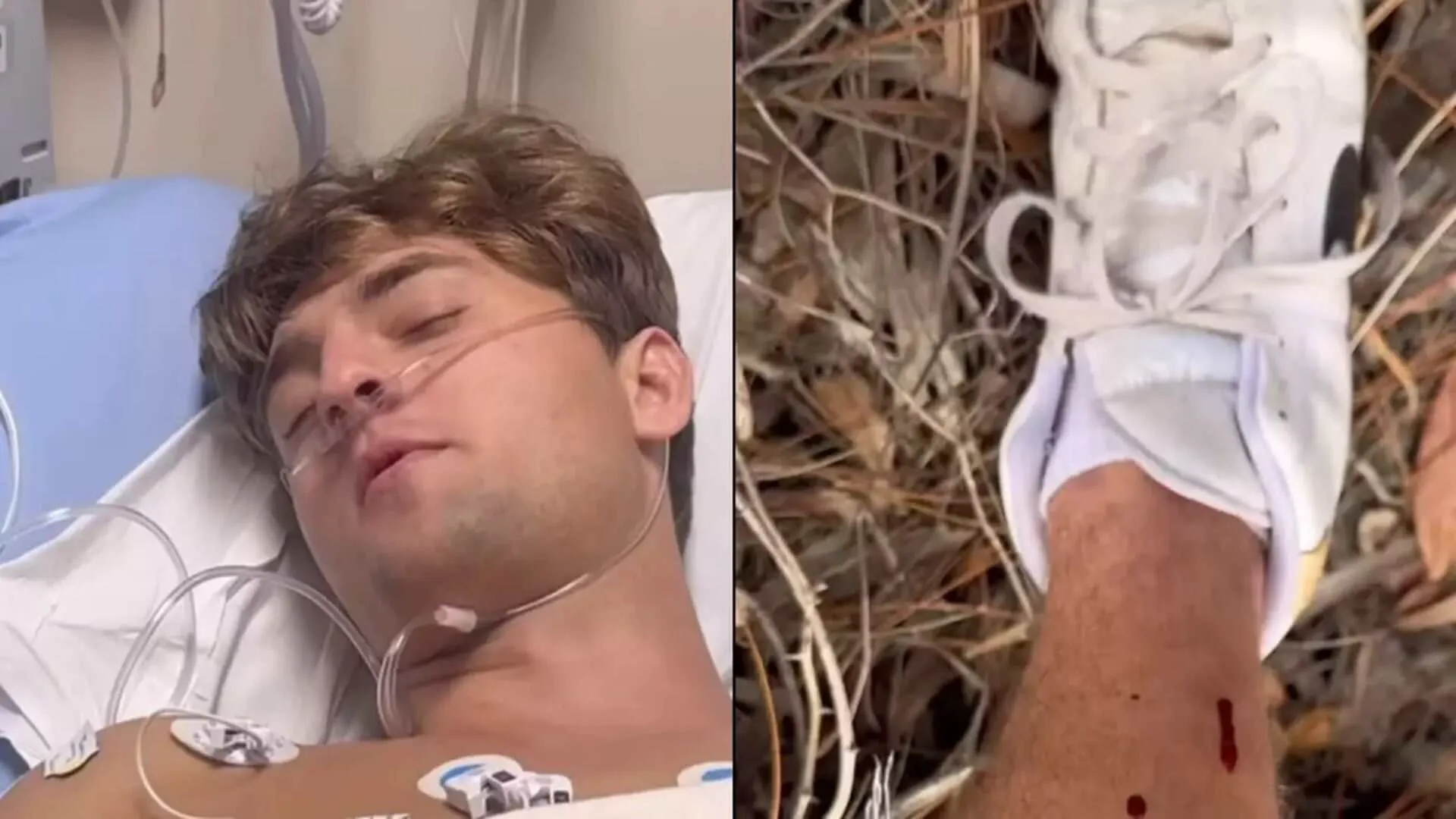 Influencer Immediately Opens Camera After Being Bitten By…
