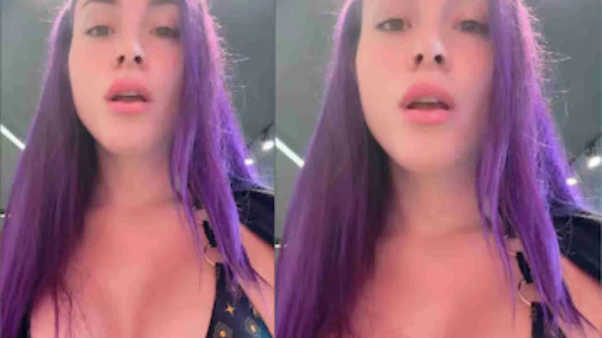 Influencer’s ‘Make Crown Out Of Them’ Rs 14 Lakh Surgery For Ribs Removal
