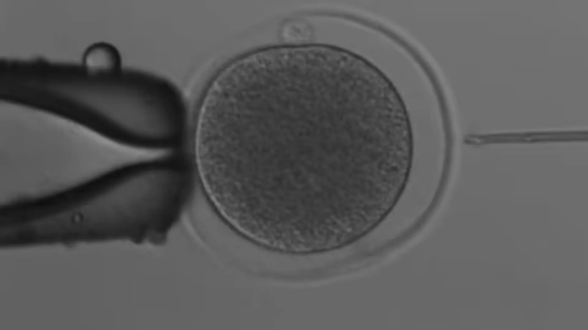 Australian Scientists Create First-Ever Kangaroo Embryo Using IVF