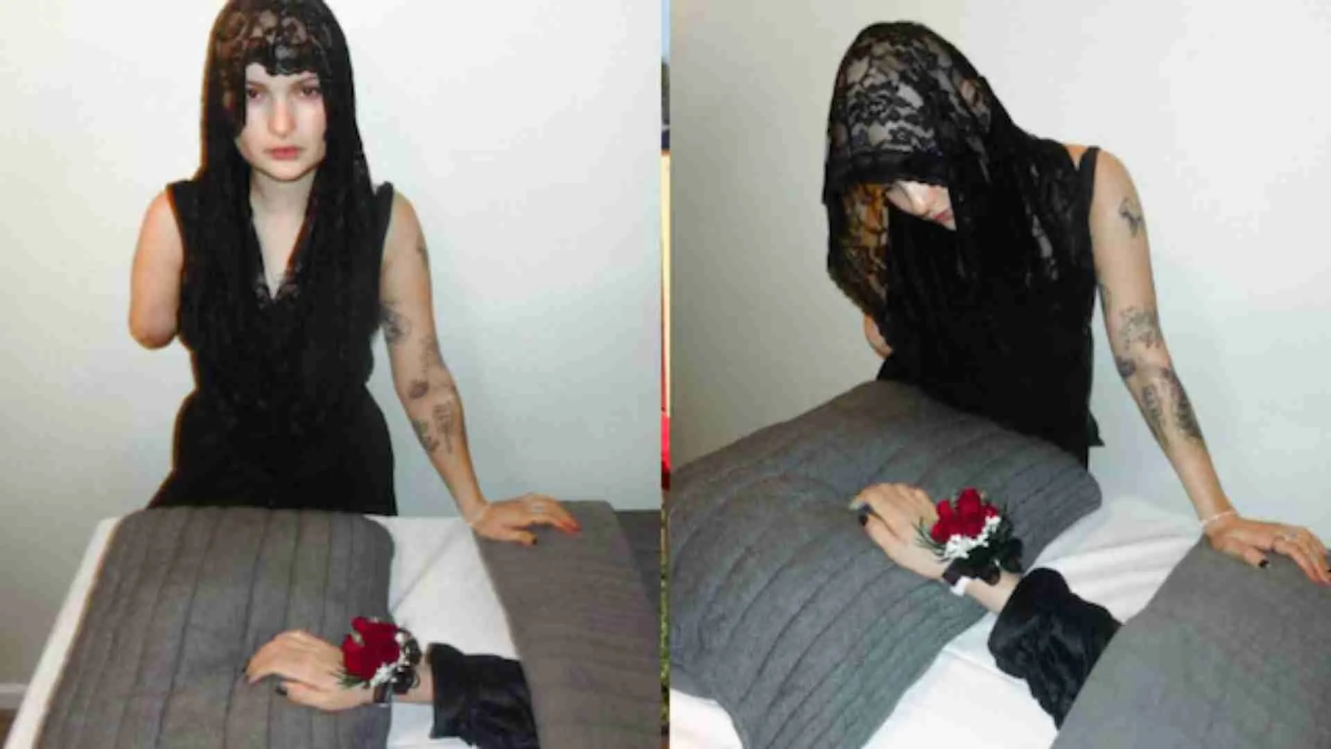 U.S. Woman Holds Funeral For Amputated Arm Lost To Cancer | PICS