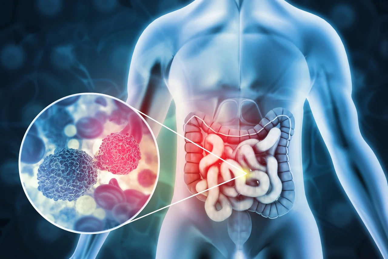Breakthrough Drug Erases Colorectal Cancer in Trial: A Medical Miracle