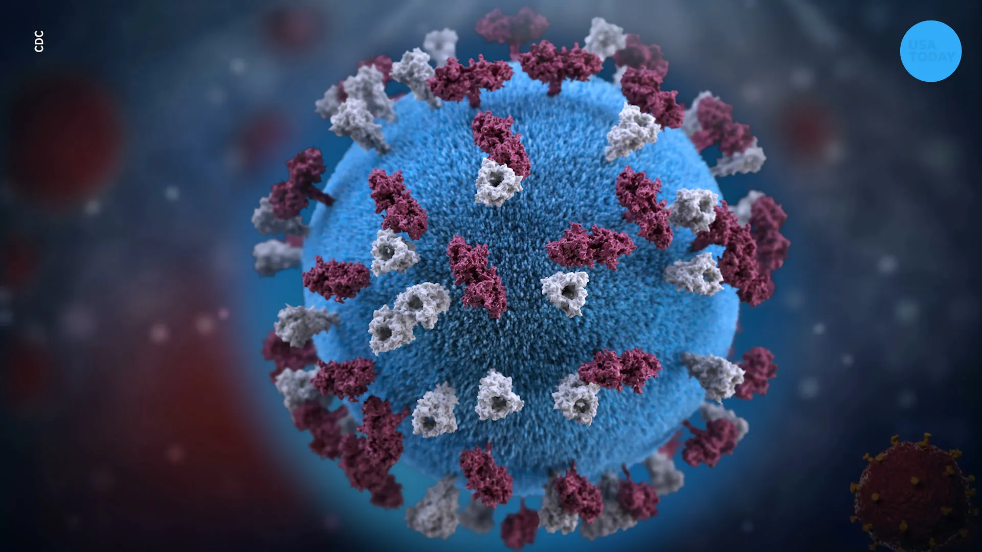 Texas Tragedy: Measles Claims First U.S. Child Death in Years