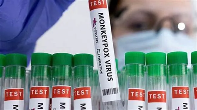 New Mpox Strain Hits New York: Global Health Concerns Rise
