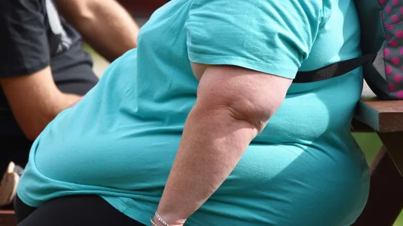 UK NHS Shifts to ‘People with Obesity’: A New Approach to Sensitive Healthcare Language