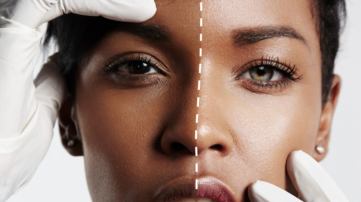 Food, Medicine, and Your Skin: How What You Eat Can Change Your Colour Forever