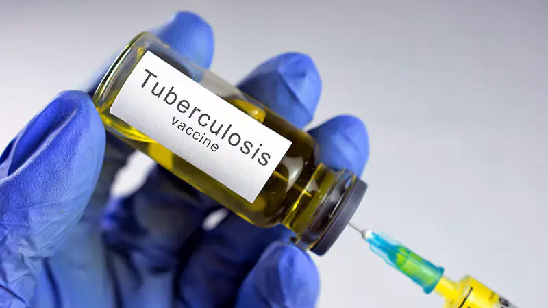 Rising Threat: Multidrug-Resistant TB in Children Demands Urgent Global Action