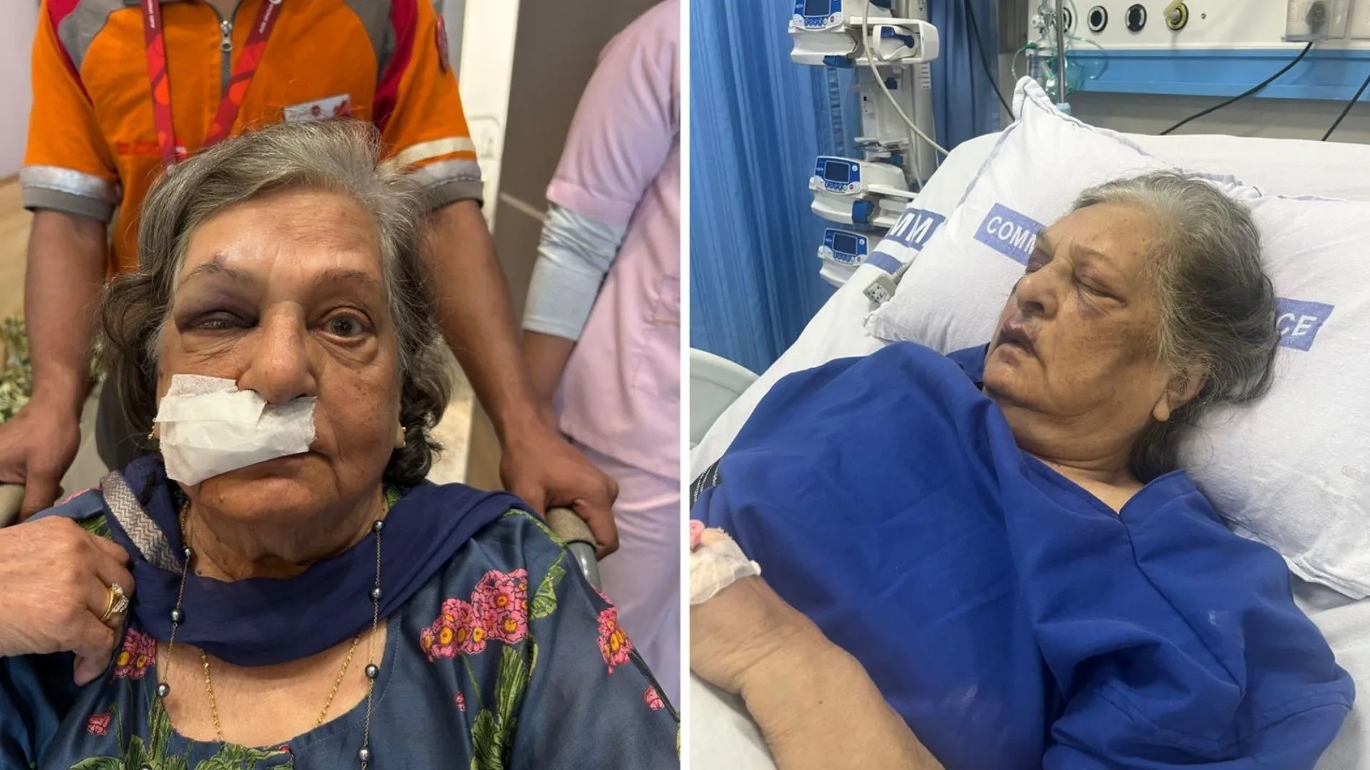Elderly Woman Falls at Airport Due to Wheelchair Delay, Air India Cites Late Arrival