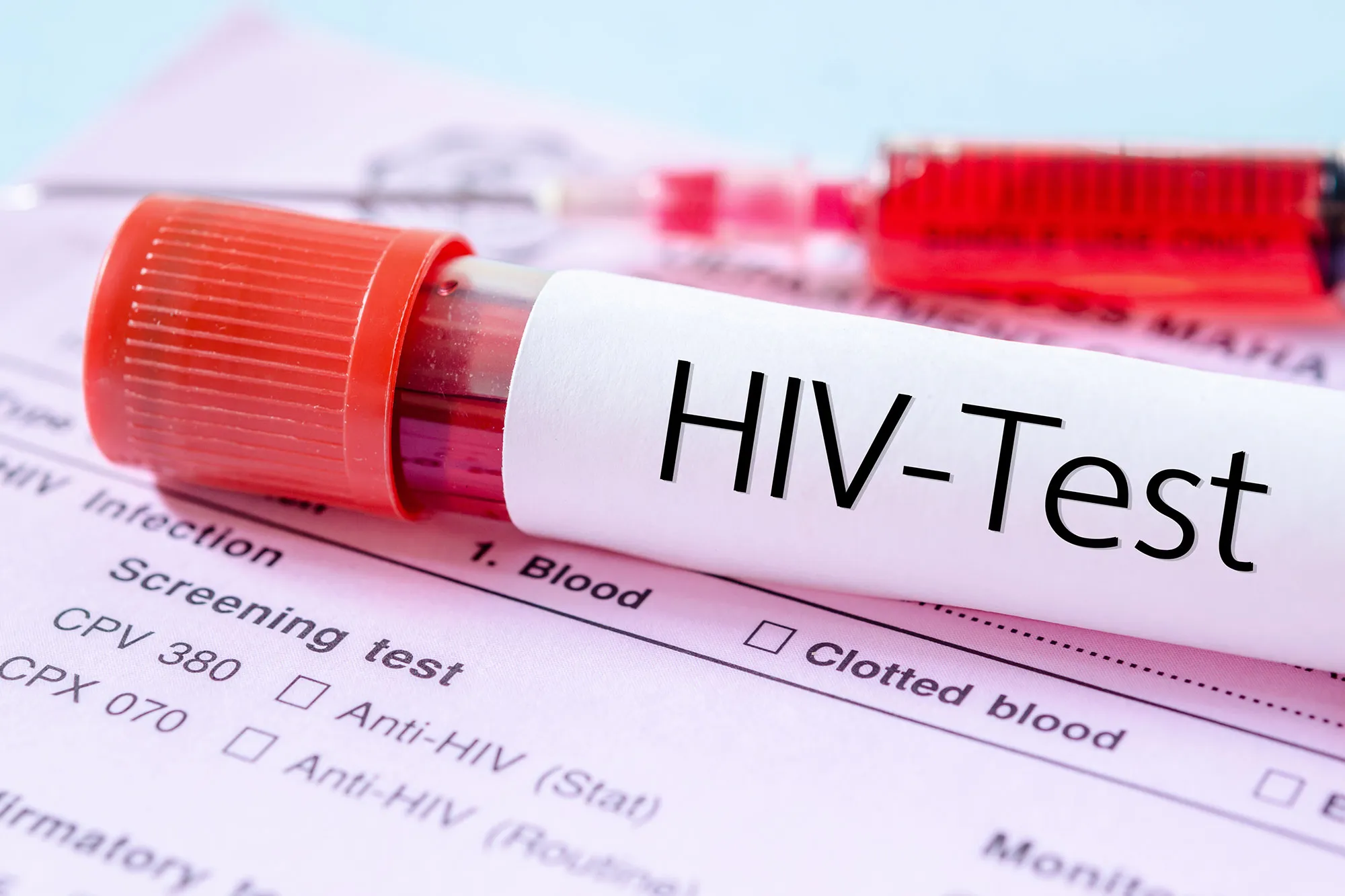 Projected Rise in HIV-Related Deaths by 2030: Global Implications