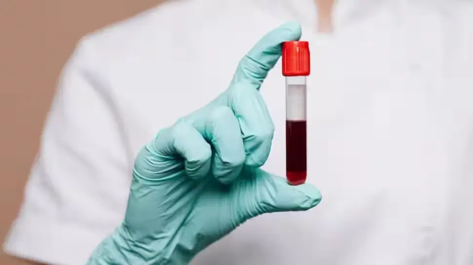 When Should Anaemia Patients Consider a Bone Marrow Transplant?
