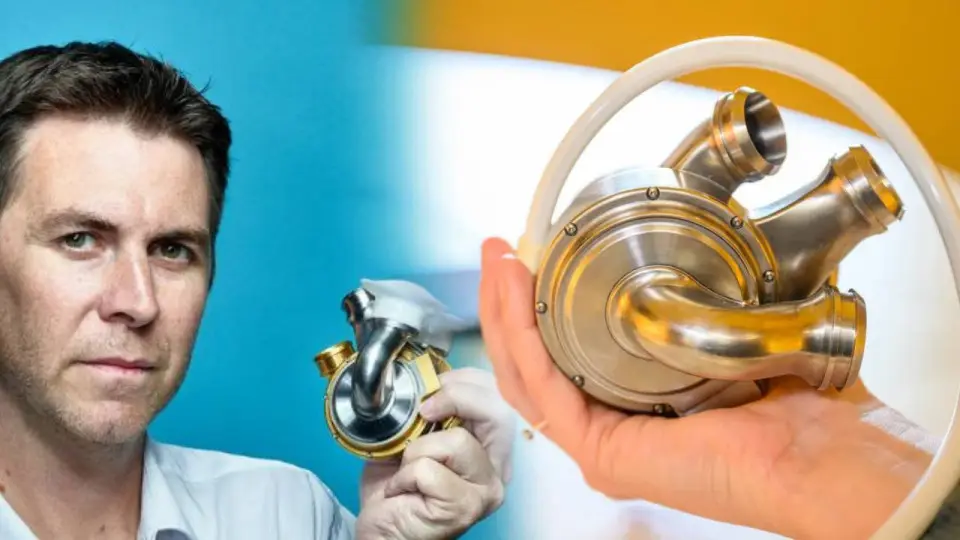 Australian Man Survives 100 Days with World-First Artificial Heart Implant