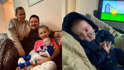 Born with an Ear on His Cheek: The Rare Case of Goldenhar Syndrome
