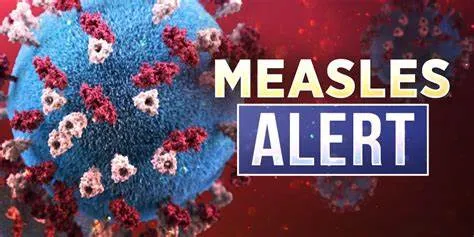 Measles Outbreak Reaches Nearly 300 Cases in Texas and New Mexico