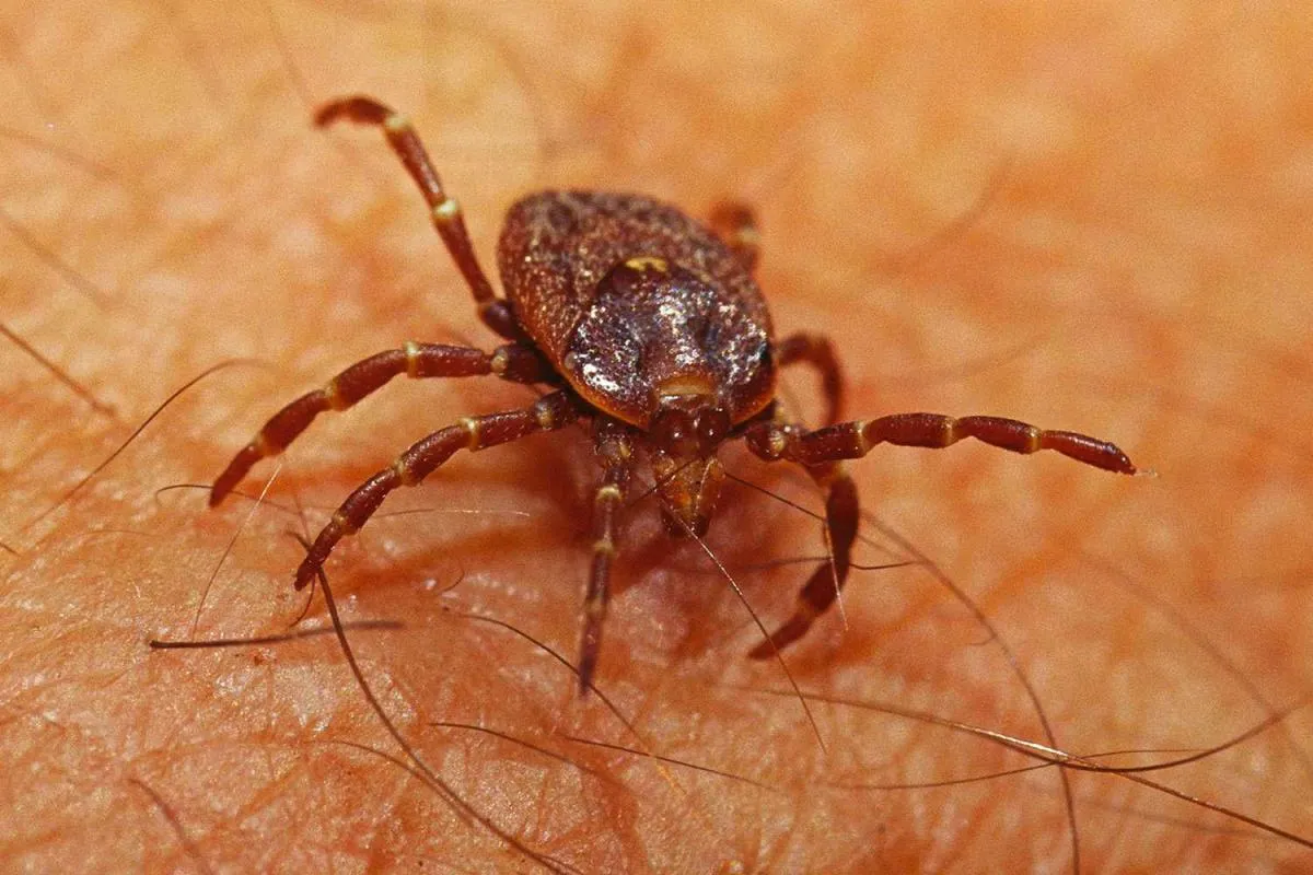 CDC Confirms Black-Legged Ticks Trigger Red Meat Allergy