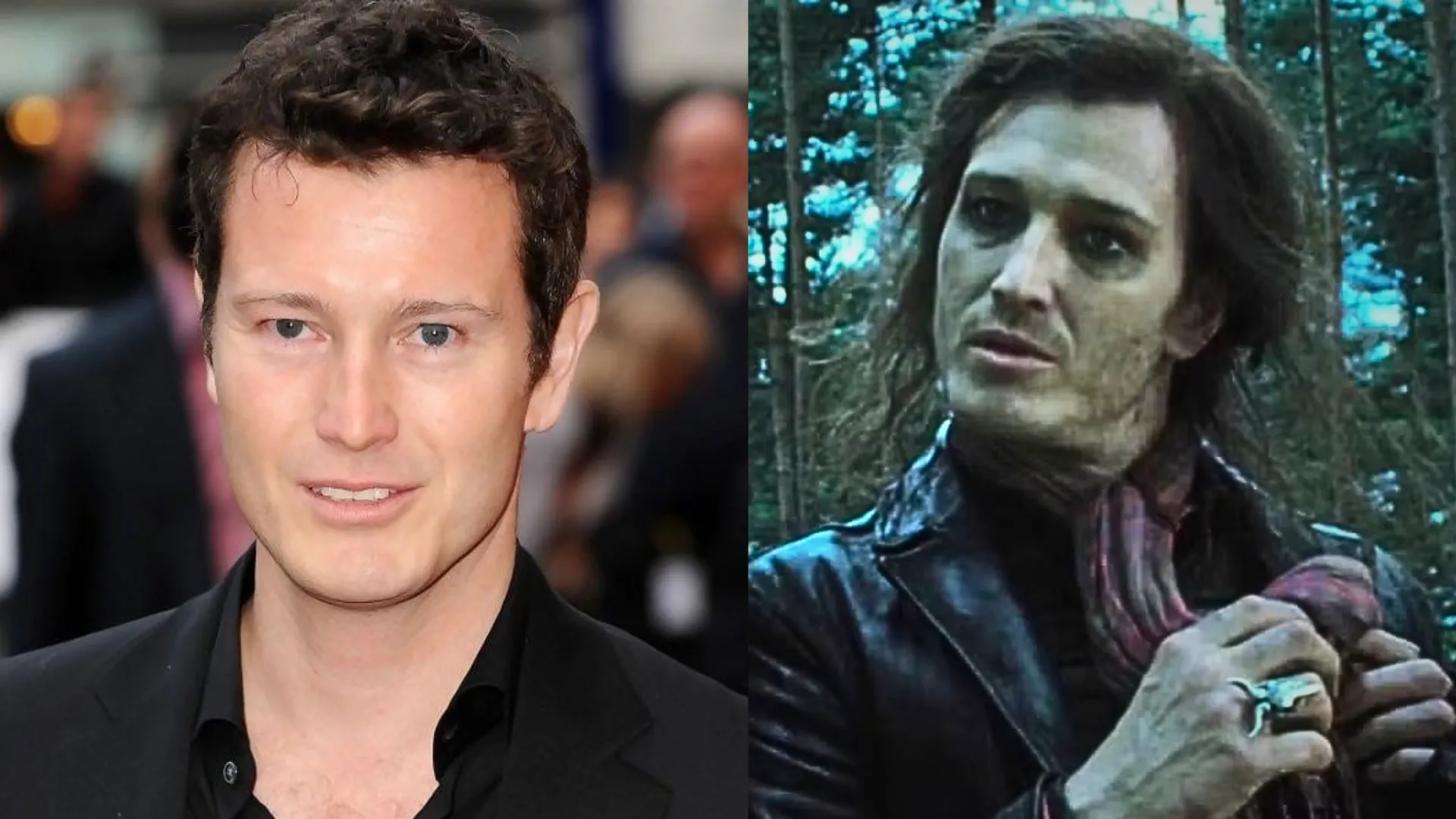 Harry Potter Star Nick Moran Undergoes Emergency Surgery