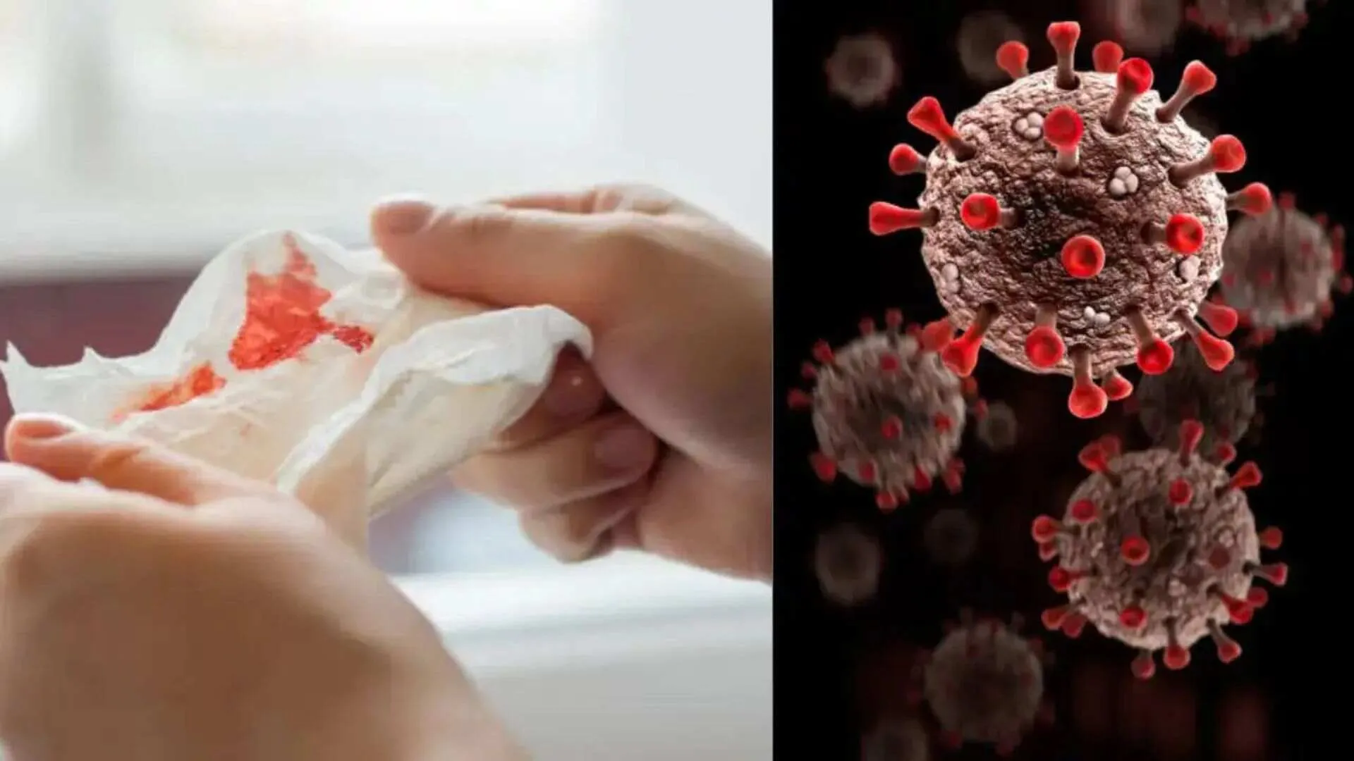 Is Russia Battling a Mystery Virus Causing Covid-Like Symptoms and Blood Coughing?