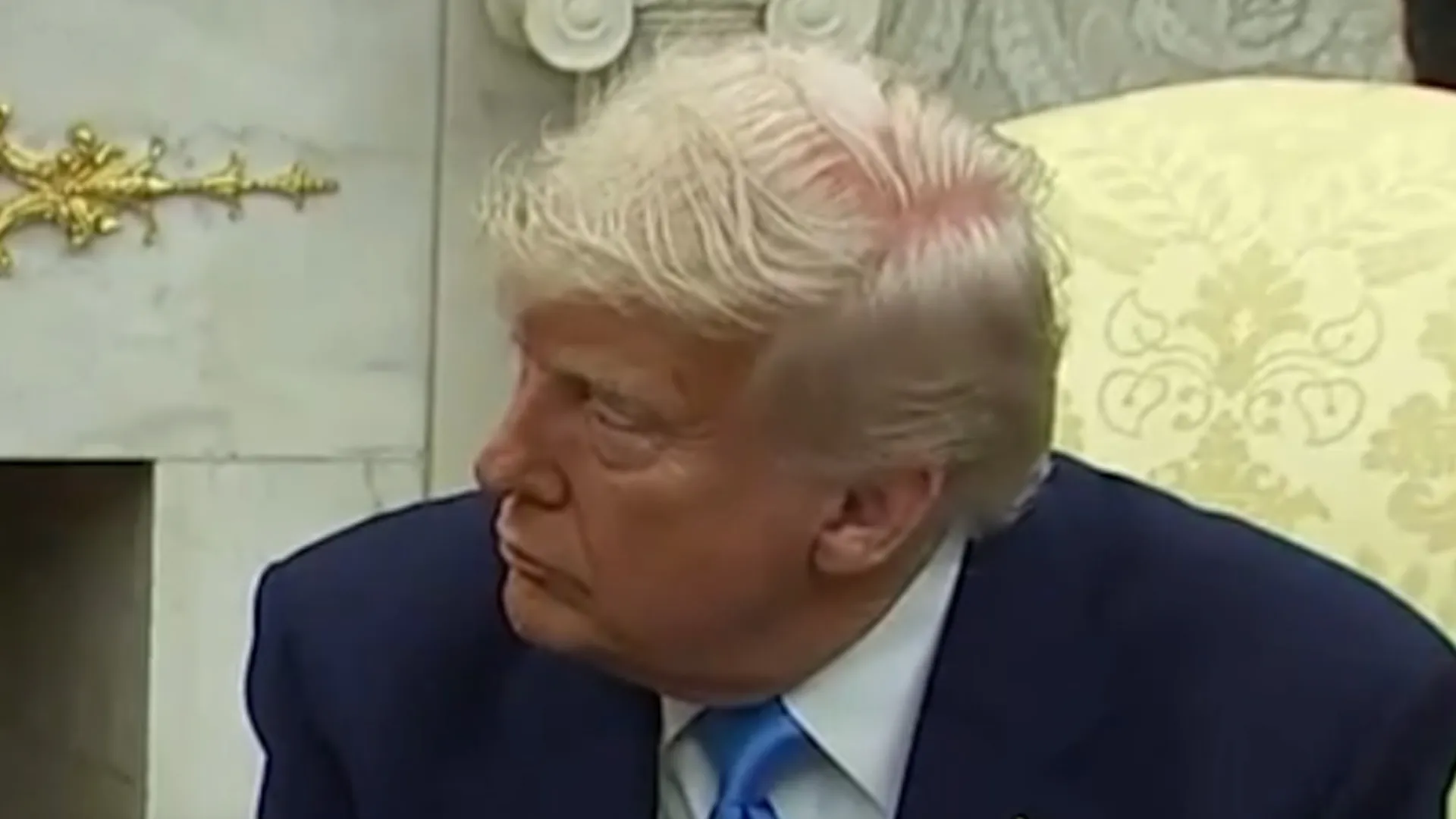 Donald Trump Laughs Off Viral Bald Spot With Hair Joke | Watch