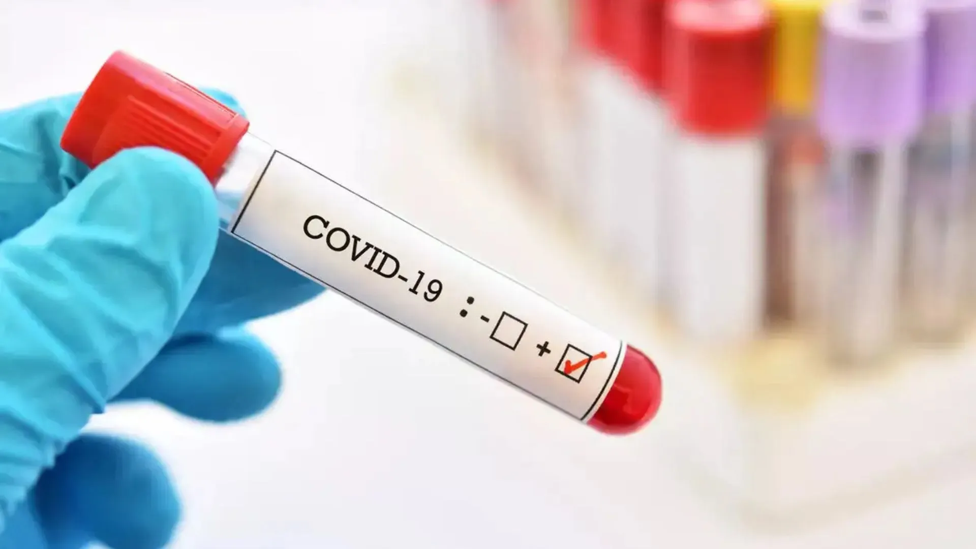 US Faces Ongoing Toll of 300 Weekly COVID-19 Deaths—What You Need to Know