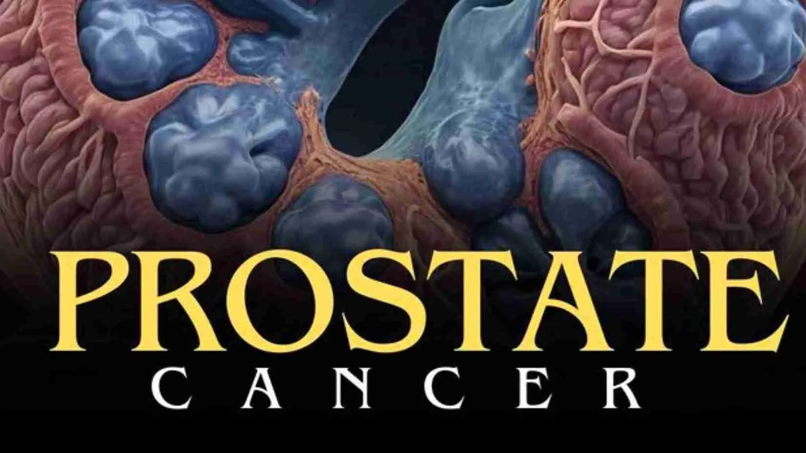 What Is Prostate Cancer? First Signs, Risk Factors, And How To Detect It Early | TDG Explainer