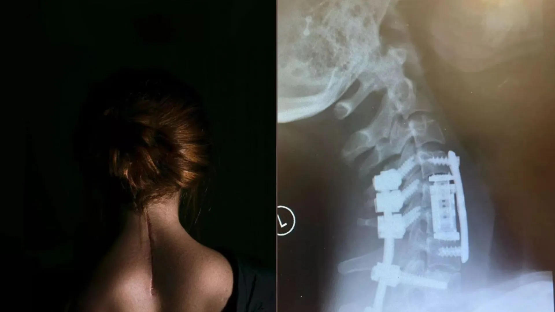 How Fitness Saved This Woman After Near Death Accident in Pool?