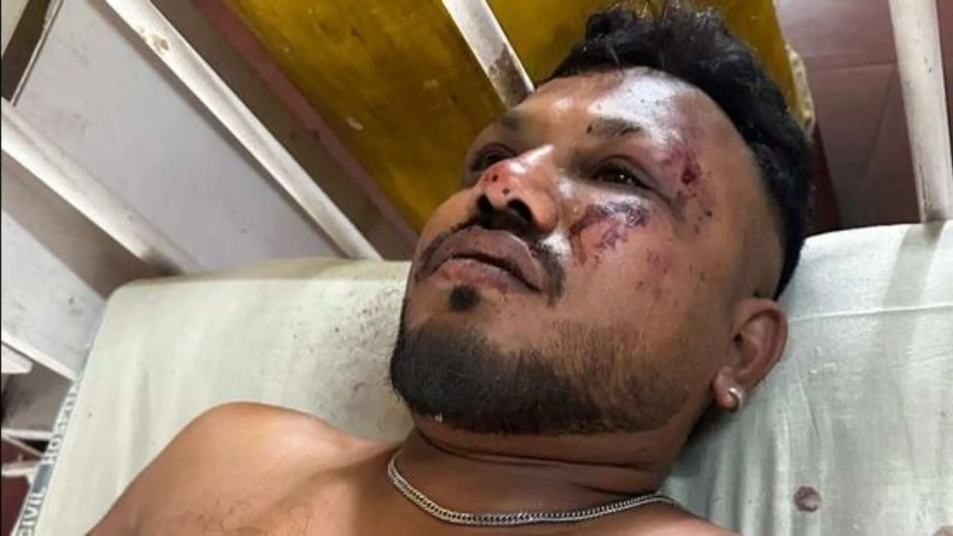 ‘I Survived the Crash’: 40-Year Old Ahmedabad Man Claims He Escaped Air India Plane Crash Alive