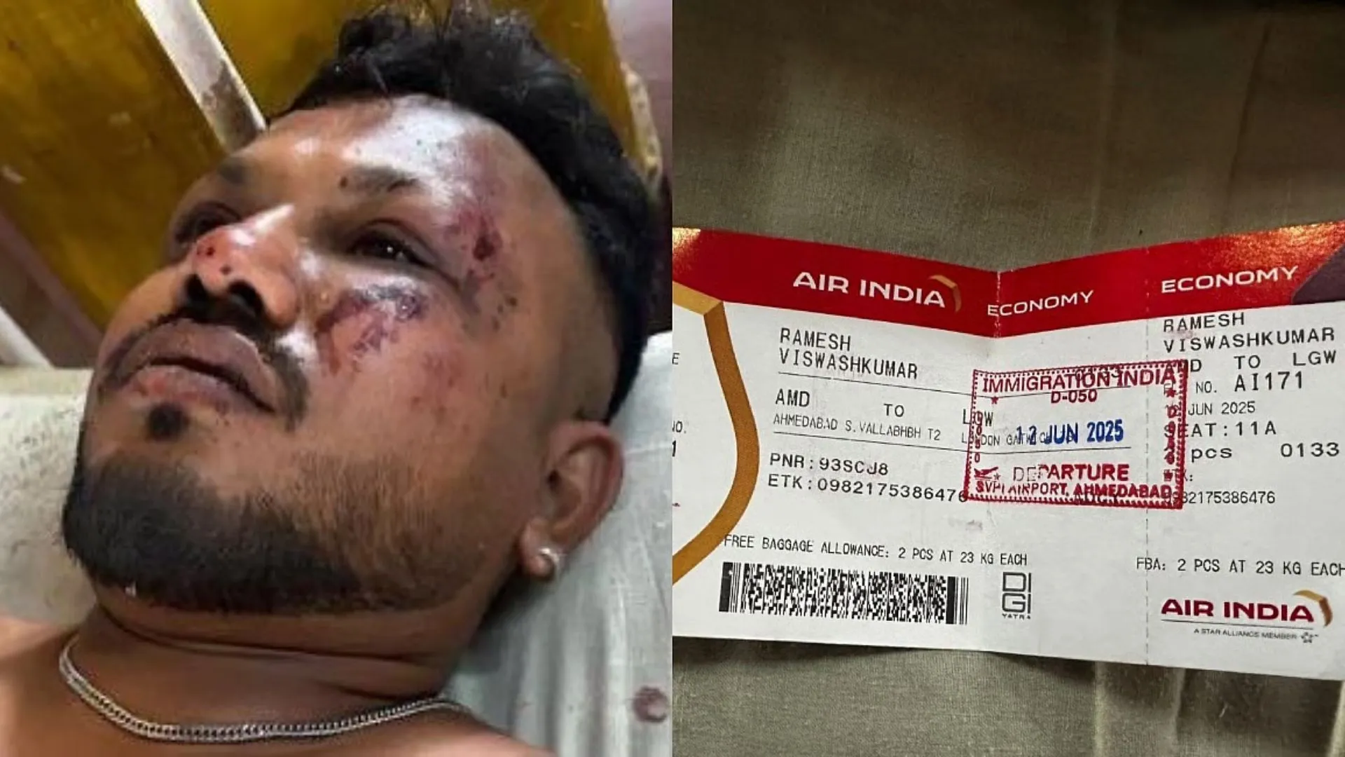 ‘Plane Split into Two and then…’ Sole Survivor Describe Devasting Air India Plane Crash | WATCH