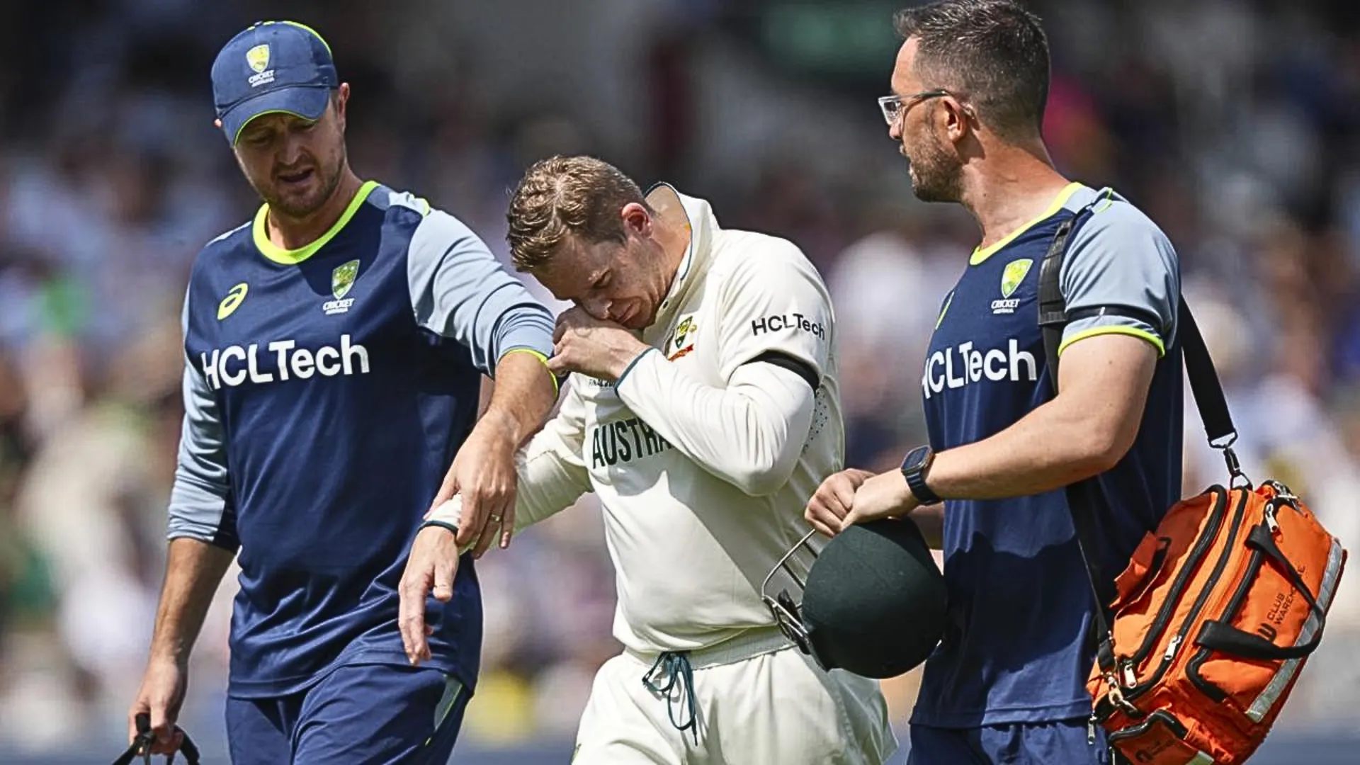 Steve Smith Suffers Finger Dislocation, Taken to Hospital for X-ray