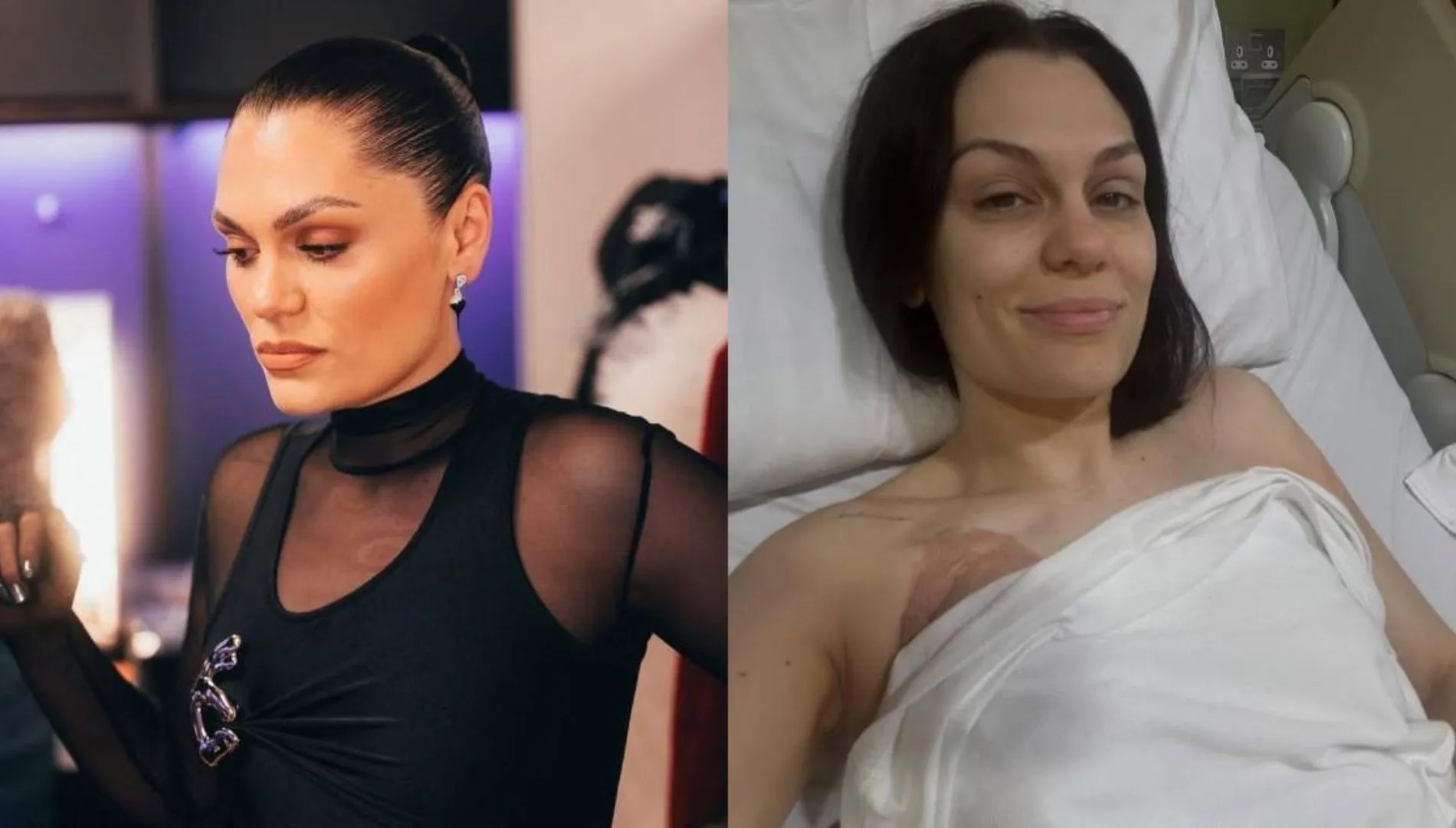 Jessie J Opens Up About Breast Cancer Surgery, Shares Honest Hospital Moments
